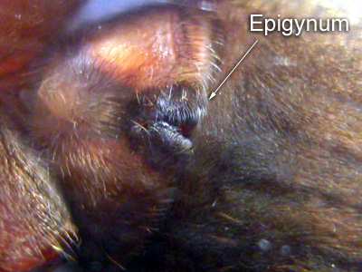 Epigynum